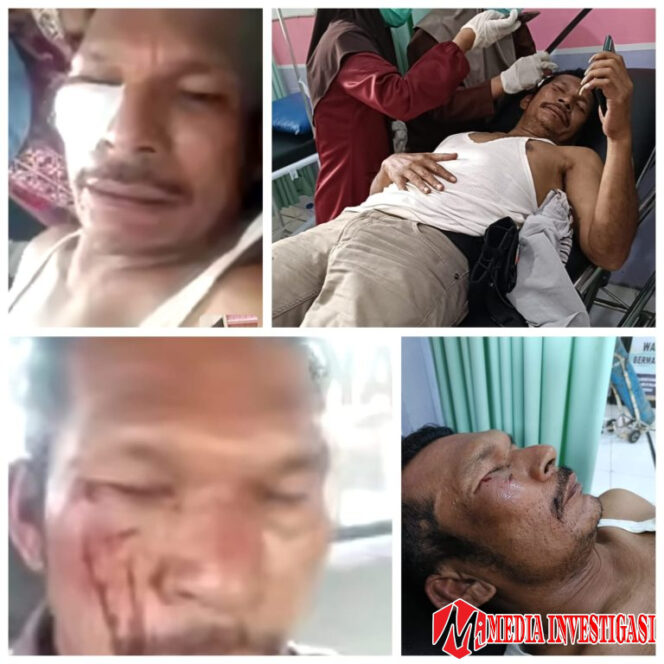 
					Ricuh Penertiban Tambang Emas di Kuansing, Wartawan Jadi Korban Kekerasan, Mobil Kapolres Dilempari Batu