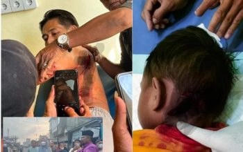 Breaking News: Korban Gigitan Monyet Liar di Inhil Bertambah Jadi 15 Orang, Seorang Anak Digigit di Bagian Leher