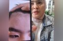 Orang tua korban dugaan perundungan di Alexandria Islamic School ketika menunjukkan luka di mata yang mengenai sarafnya dan beberapa anggota tubuh lainnya. (Dok. MEDIA INVESTIGASI)