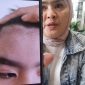 Orang tua korban dugaan perundungan di Alexandria Islamic School ketika menunjukkan luka di mata yang mengenai sarafnya dan beberapa anggota tubuh lainnya. (Dok. MEDIA INVESTIGASI)