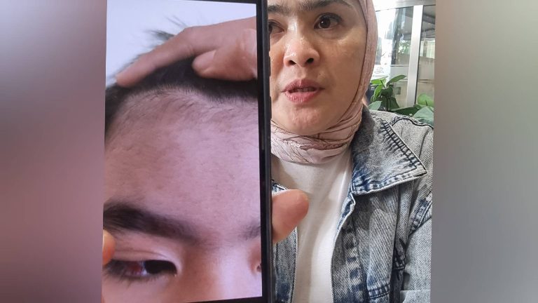Orang tua korban dugaan perundungan di Alexandria Islamic School ketika menunjukkan luka di mata yang mengenai sarafnya dan beberapa anggota tubuh lainnya. (Dok. MEDIA INVESTIGASI)